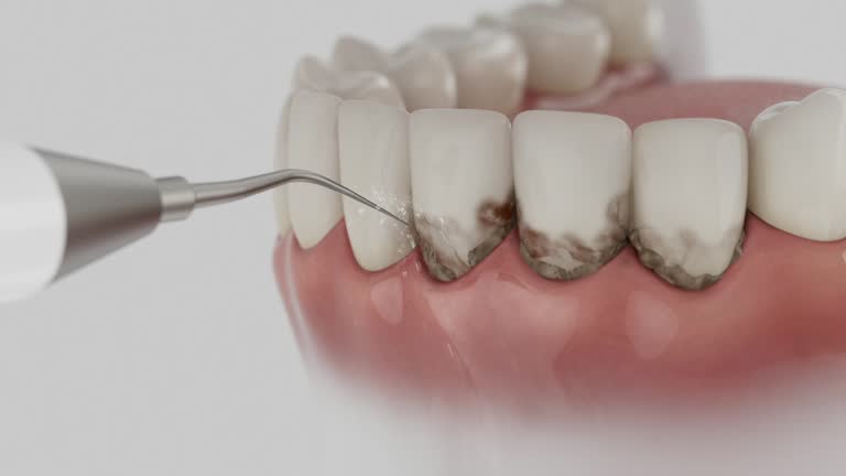 Reliable Dental Implants contractor in Mountain View, MO by Smile Center Dentistry